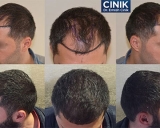 Dr. Cinik – Medical Aesthetics and Hair Restoration Centre in Turkey