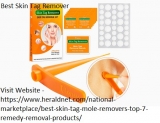 Make Everything Easy With Best Skin Tag Removal Products