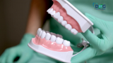 Dental Implant Jaipur | Dental Implant in Diabetic Patient