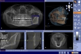 CBCT dental imaging market Latest Developments on Professional Inputs