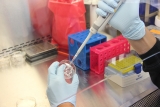 Cancer Immunotherapy Drug Discovery Outsourcing Market Size, Share, Growth and Forecast Report, 2018 to 2025