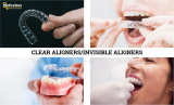 Invisible Aligners Market to be worth $18.8 Billion by 2030
