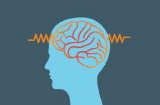 Epilepsy Market Size, Share, Opportunities, Development Status, Business Growth and Regional Forecast To 2026