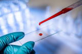 France In-Vitro Diagnostics market shall reach US$ 4.03 Billion in 2028