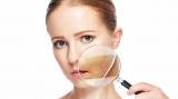 Hyperpigmentation Disorders Treatment Market Insight Research and Forecast Report 2019