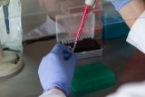 In Vitro Diagnostics Quality Control Market Size, Share and Trends Analysis Report, 2019 to 2026