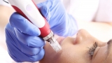 Medical Aesthetics Market Insights to Study Capacity, Cost Estimation, Value, Share and New Development in future till 2023