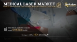Medical Laser Market- Global Opportunity Analysis and Industry Forecast (2021–2028)