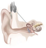 Global Neurostimulation Devices Market Size, Share, Growth and Forecast Report, 2019 to 2026
