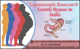 Obesity treatment in Adults with Bariatric Surgeries in India