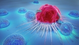 Research shows 17 percent of cancers a result of infection