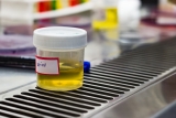 Urine Cytology Market Analysis Depending Upcoming Innovations and Trends
