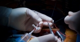 Vascular Graft Market Process Chain, Demand, Size, Trends and Technology Insights Report 2019