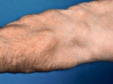 Is Botox Safe and Worth It? Honest Review from Irvine CA Experts