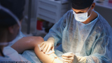 Best Vascular Surgery Doctor In Bhopal – Dr. Dileep Singh Rathore